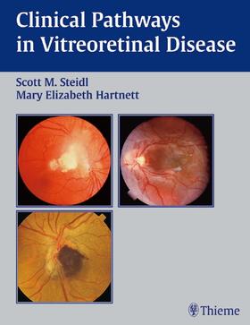 Scott M. Steidl |  Clinical Pathways in Vitreoretinal Disease | Buch |  Sack Fachmedien