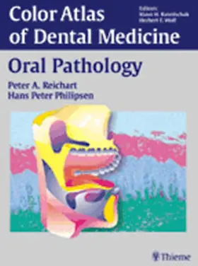 Reichart / Philipsen | Oral Pathology | Buch | 978-3-13-125881-6 | sack.de