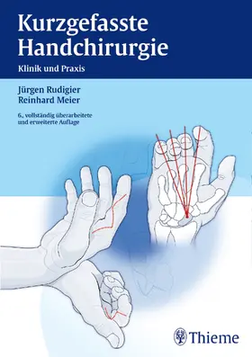 Rudigier / Meier |  Kurzgefasste Handchirurgie | Buch |  Sack Fachmedien