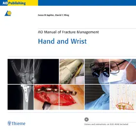 Jupiter / Ring |  AO Manual of Fracture Management - Hand and Wrist | Buch |  Sack Fachmedien