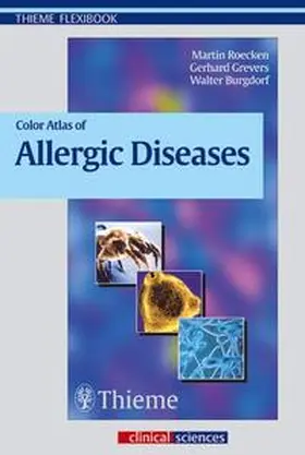 Röcken / Grevers / Burgdorf |  Color Atlas of Allergic Diseases | Buch |  Sack Fachmedien