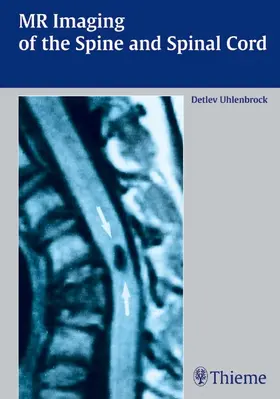 Uhlenbrock |  MR Imaging of the Spine and Spinal Cord | Buch |  Sack Fachmedien