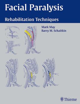 M. May |  Facial Paralysis | Buch |  Sack Fachmedien