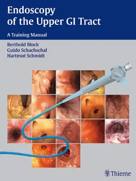 Block / Schachschal / Schmidt |  Endoscopy of the Upper GI Tract | Buch |  Sack Fachmedien