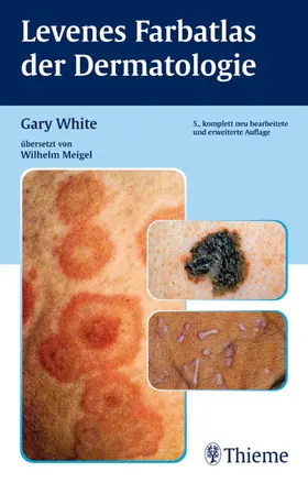White / Gary White |  Levenes Farbatlas der Dermatologie | Buch |  Sack Fachmedien