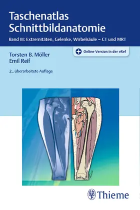 Möller / Reif |  Taschenatlas Schnittbildanatomie 03 | Buch |  Sack Fachmedien