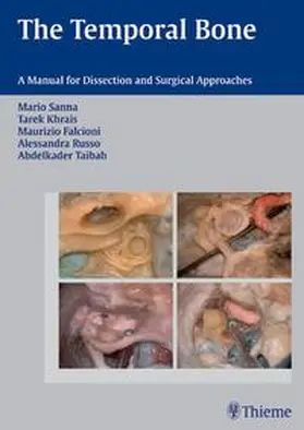 Sanna / Khrais / Falcioni | The Temporal Bone | Buch | 978-3-13-141271-3 | sack.de