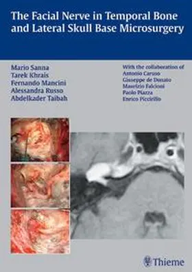 Khrais / Sanna / Mancini | The Facial Nerve in Temporal Bone and Lateral Skull Base Microsurgery | Buch | 978-3-13-141281-2 | sack.de