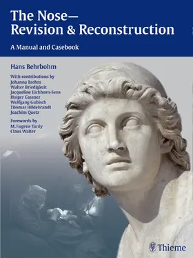 Behrbohm / Eichhorn-Sens / Quetz |  The Nose - Revision and Reconstruction | Buch |  Sack Fachmedien