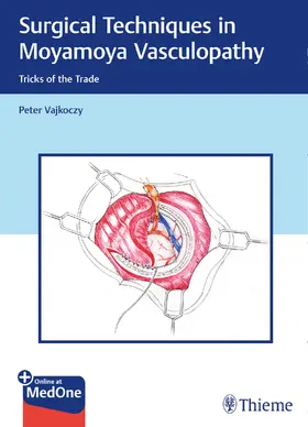 Vajkoczy |  Surgical Techniques in Moyamoya Vasculopathy | Buch |  Sack Fachmedien