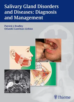 Bradley / Guntinas-Lichius |  Salivary Gland Disorders and Diseases: | Buch |  Sack Fachmedien