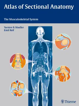 Möller / Reif |  Atlas of Sectional Anatomy | Buch |  Sack Fachmedien