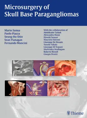 Sanna / Piazza / Shin |  Microsurgery of Skull Base Paragangliomas | eBook | Sack Fachmedien