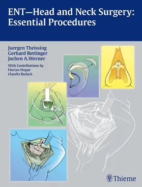 Theissing / Rettinger / Werner |  ENT Head and Neck Surgery: Essential Procedures | Buch |  Sack Fachmedien