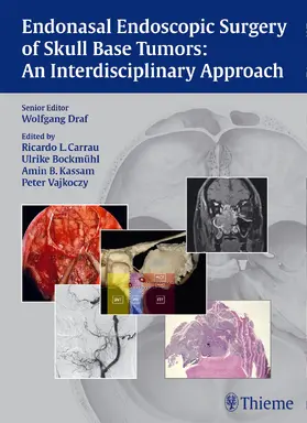 Draf / Carrau / Bockmühl |  Endonasal Endoscopic Surgery of Skull Base Tumors: An Interdisciplinary Approach | Buch |  Sack Fachmedien