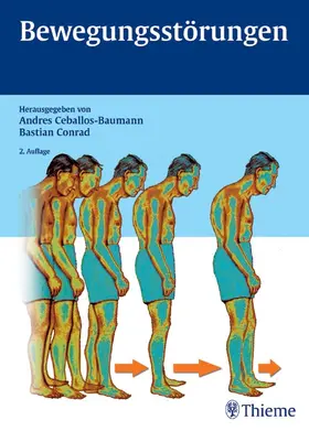 Ceballos-Baumann / Conrad |  Bewegungsstörungen | eBook | Sack Fachmedien