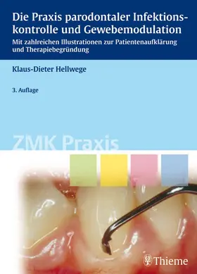 Hellwege | Die Praxis parodontaler Infektionskontrolle und Gewebemodulation | E-Book | sack.de