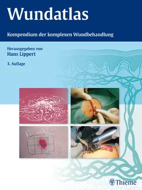 Lippert |  Wundatlas | eBook | Sack Fachmedien