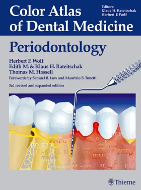 Wolf / Hassell / Rateitschak-Pluss | Color Atlas of Dental Medicine: Periodontology | E-Book | sack.de