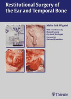 Wigand / Laszig / Rettinger |  Restitutional Surgery of the Ear and Temporal Bone | eBook | Sack Fachmedien