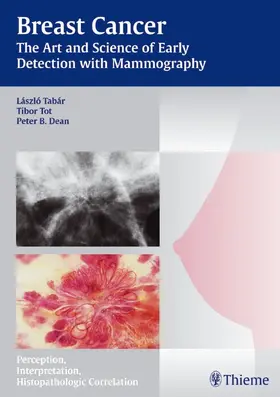 Tabar / Tot / Dean |  Breast Cancer - The Art and Science of Early Detection with Mammography | eBook | Sack Fachmedien