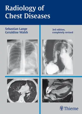 Lange / Walsh | Radiology of Chest Diseases | E-Book | sack.de