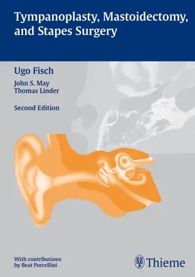 Fisch / May / Porcellini |  Tympanoplasty, Mastoidectomy, and Stapes Surgery | eBook | Sack Fachmedien
