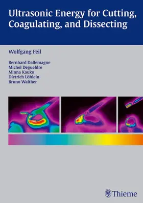 Feil / Dallemagne / Degueldre |  Ultrasonic Energy for Cutting, Coagulating, and Dissecting | eBook | Sack Fachmedien