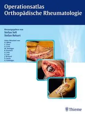Sell / Rehart |  Operationsatlas Orthopädische Rheumatologie | Buch |  Sack Fachmedien