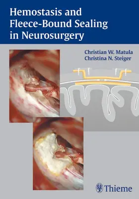 Matula / Steiger |  Hemostasis and Fleece-Bound Sealing in Neurosurgery | eBook | Sack Fachmedien