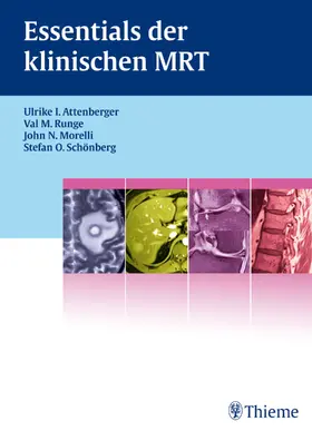 Runge |  Essentials der klinischen MRT | eBook | Sack Fachmedien