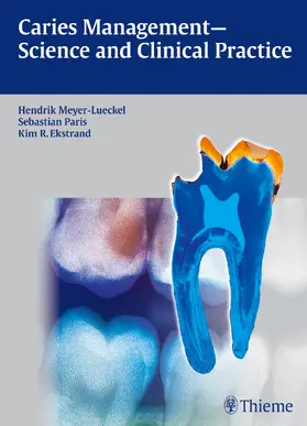 Meyer-Lueckel / Paris / Ekstrand |  Caries Management - Science and Clinical Practice | eBook | Sack Fachmedien