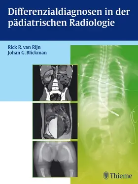 Van Rijn / Blickman |  Differenzialdiagnosen in der pädiatrischen Radiologie | Buch |  Sack Fachmedien