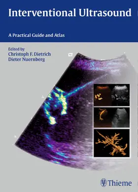 Dietrich / Nürnberg |  Interventional Ultrasound | eBook | Sack Fachmedien