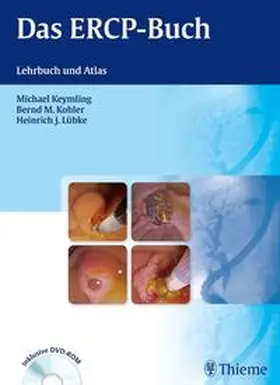 Lübke, Heinrich-J. |  Das ERCP-Buch | eBook | Sack Fachmedien