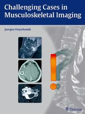 Freyschmidt |  Challenging Cases in Musculoskeletal Imaging | Buch |  Sack Fachmedien
