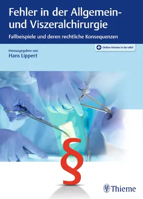 Lippert |  Fehler in der Allgemein- und Viszeralchirurgie | Buch |  Sack Fachmedien