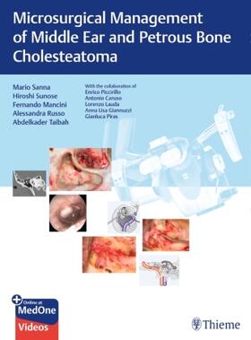 Sanna / Sunose / Mancini |  Microsurgical Management of Middle Ear and Petrous Bone Cholesteatoma | Buch |  Sack Fachmedien