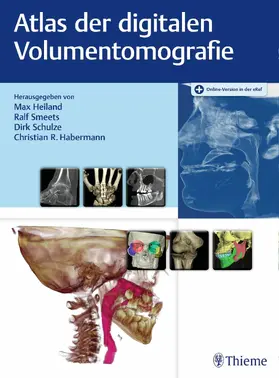 Heiland / Smeets / Schulze | Digitale Volumentomografie | E-Book | sack.de