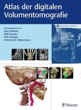 Heiland / Smeets / Schulze |  Digitale Volumentomografie | eBook | Sack Fachmedien