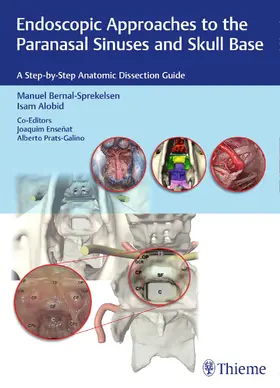 Bernal-Sprekelsen / Alobid / Ensenat | Endoscopic Approaches to the Paranasal Sinuses and Skull Base | E-Book | sack.de