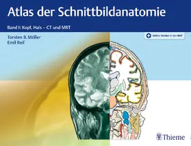 Möller / Reif |  Atlas der Schnittbildanatomie. Band 01 | Buch |  Sack Fachmedien