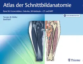 Möller / Reif |  Atlas der Schnittbildanatomie | eBook | Sack Fachmedien