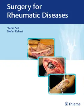 Sell / Rehart |  Surgery for Rheumatic Diseases | Buch |  Sack Fachmedien