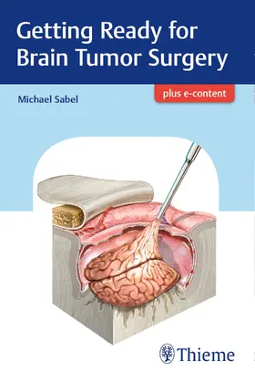 Sabel | Getting Ready for Brain Tumor Surgery | E-Book | sack.de