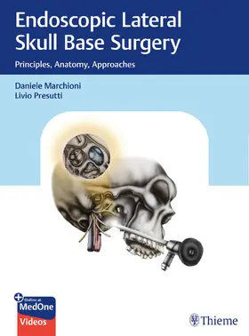 Marchioni / Presutti |  Endoscopic Lateral Skull Base Surgery | Buch |  Sack Fachmedien