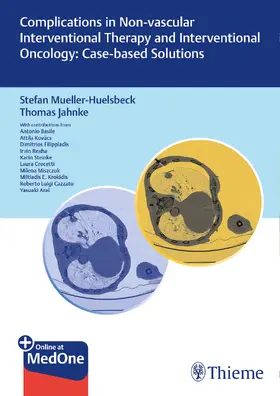 Müller-Hülsbeck / Jahnke |  Complications in Non-vascular Interventional Therapy and Interventional Oncology: Case-based Solutions | Buch |  Sack Fachmedien