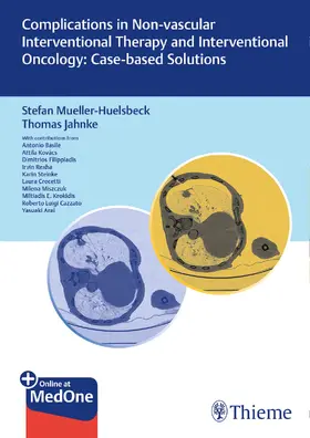 Müller-Hülsbeck / Jahnke |  Complications in Non-vascular Interventional Therapy and Interventional Oncology: Case-based Solutions | eBook | Sack Fachmedien