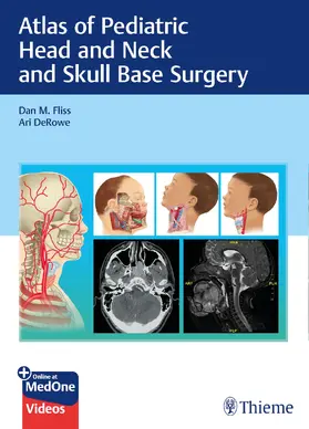 Fliss / DeRowe |  Atlas of Pediatric Head and Neck and Skull Base Surgery | Buch |  Sack Fachmedien