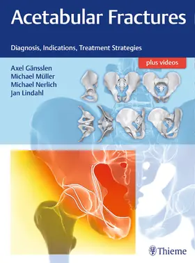 Gänsslen / Müller / Nerlich |  Acetabular Fractures | eBook | Sack Fachmedien